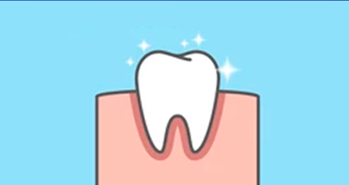 Cavity Filling | Tooth Filling | Dental Filling Treatment at Home